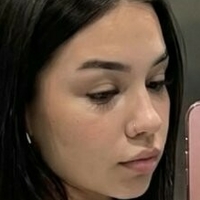 Джиадаранзе Голая